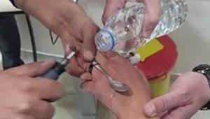 Elazığ'da itfaiyeden yüzük çıkarma operasyonu