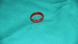 Oyun oynarken yerdeki yüzüğü yutan 3 yaşındaki çocuk ölümden döndü