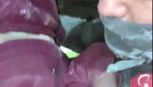 Küçük Mina'nın umut veren bakışları