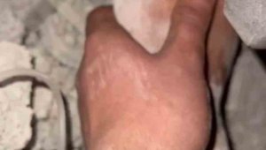 Niğde UMKE ekiplerinden enkaz altındaki vatandaşa hayat eli