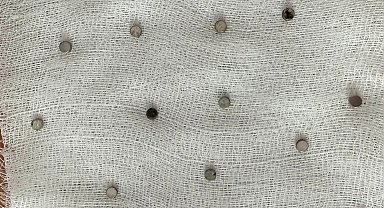 Çocuğun boğazından 19 adet mıknatıs çıkartıldı